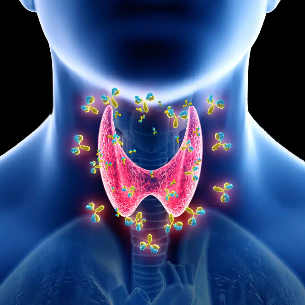 Thyroid-Troubles-Strategies-for-Managing-Thyroid-Disorders.webp